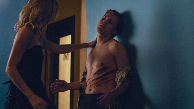 Điên rồ (Rabid 2021)