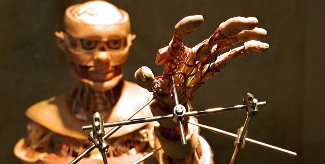 Giải phẫu (Anatomy 2000)