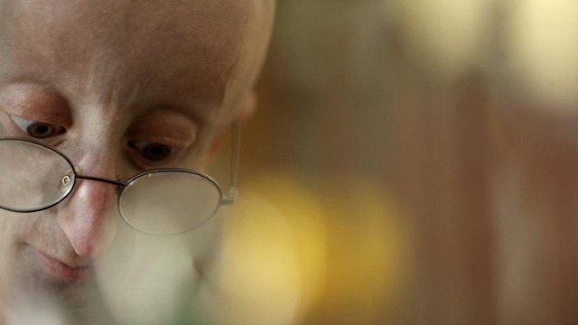 Góc Nhìn Cuộc Sống Của Sam (Life According to Sam 2013)