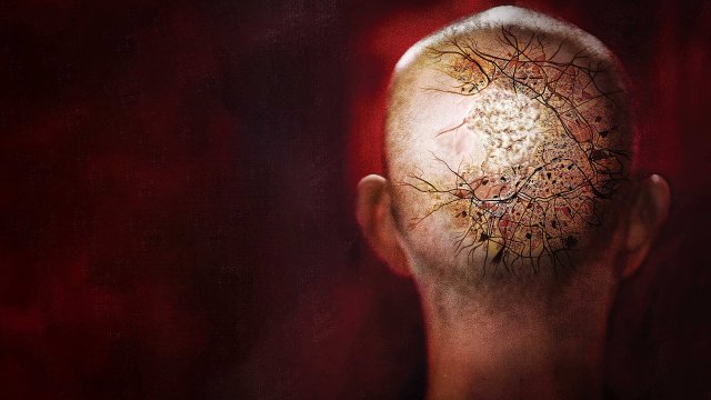  Sức Mạnh Dị Thường (Afflicted 2014)
