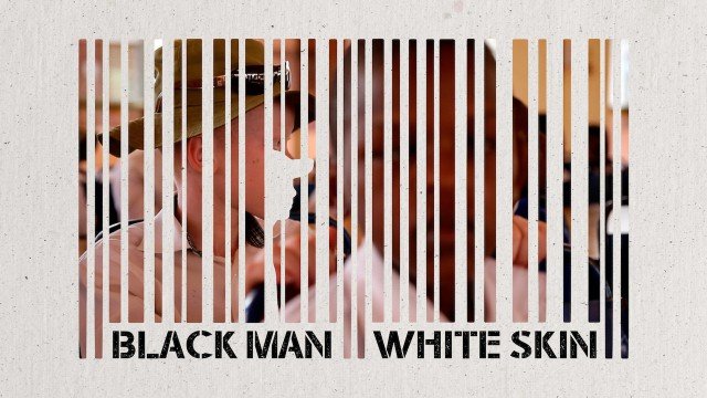 Phận Da Đen, Thân Da Trắng (Black Man White Skin 2015)
