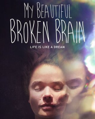 Khối óc xinh đẹp tội nghiệp của tôi (My Beautiful Broken Brain 2016)